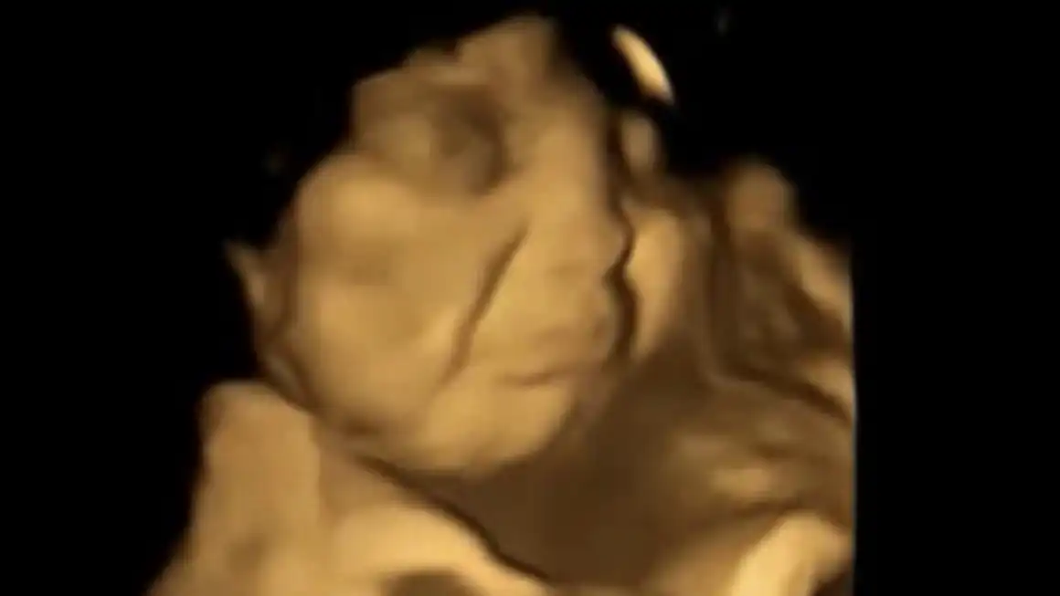 fetus 4D ultrazvuk kelj_ Jackie Blissett Twitter-1663934549196.webp
